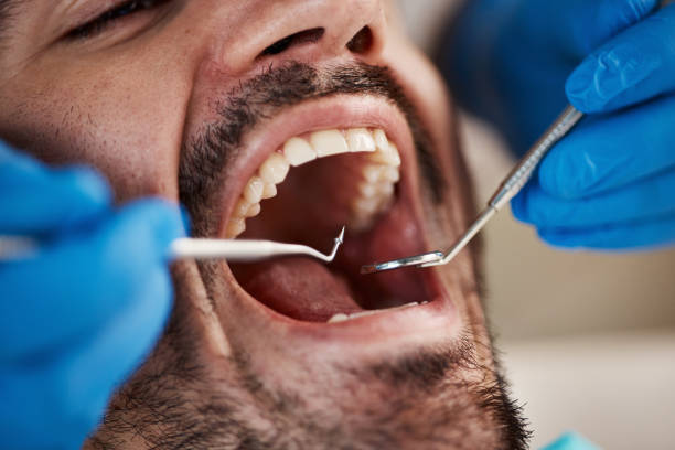 Best Emergency Dental Extractions in Shields, MI