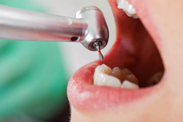 Best Emergency Cosmetic Dentistry in Shields, MI